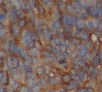 UQCC2 Antibody