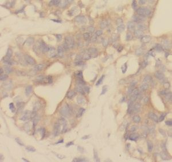 UQCRB Antibody