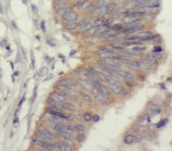 UQCRC2 antibody