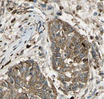UROS Antibody