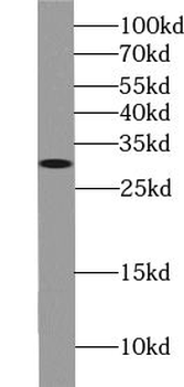 USE1 Rabbit Polyclonal Antibody