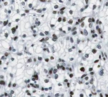 USF1 Antibody