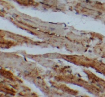 USHBP1 Antibody