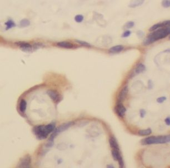 ATP5MK Antibody