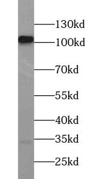 USP10 Rabbit Polyclonal Antibody