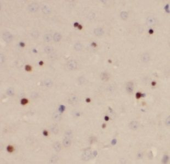 USP11 Antibody