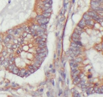 USP11 Antibody