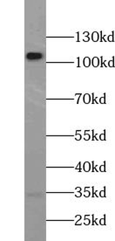 USP15 Antibody