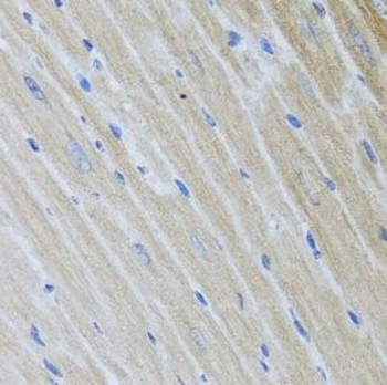 USP25 Antibody