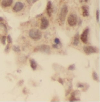 USP28 Antibody