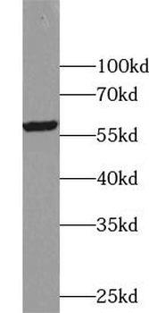USP3 Rabbit Polyclonal Antibody