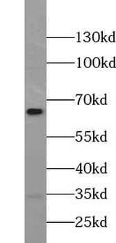 USP39 Rabbit Polyclonal Antibody