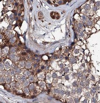 USP50 Antibody