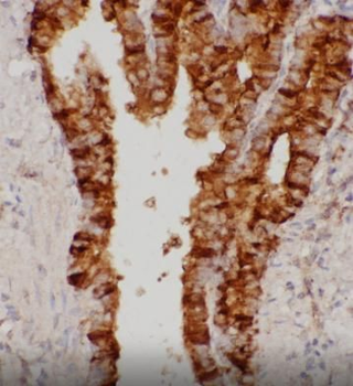 SCGB1A1 Antibody