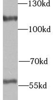 UTP14A Antibody