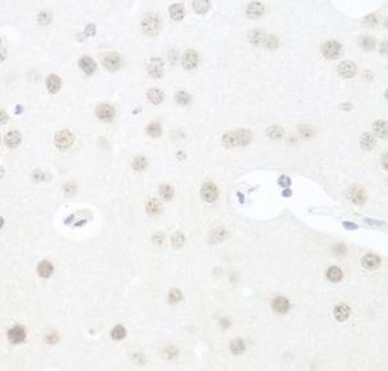 UTP14A Antibody