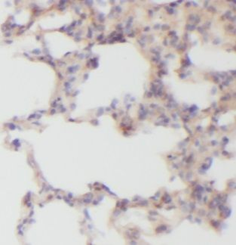 VAC14 Antibody