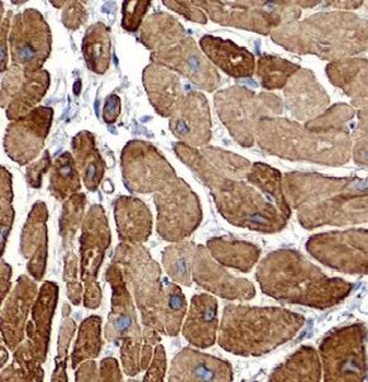 VAMP3 Antibody