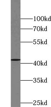 VASH1 Rabbit Polyclonal Antibody