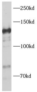 VCPIP1 Rabbit Polyclonal Antibody
