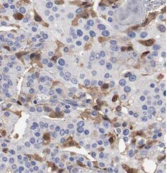VDAC2 Antibody