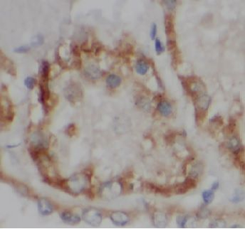 VDAC2 Antibody