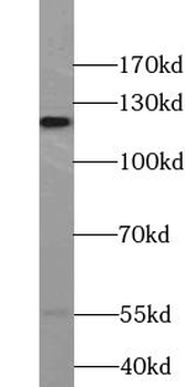 VEZT Antibody