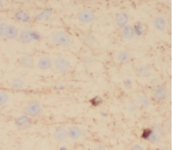 VEZT Antibody