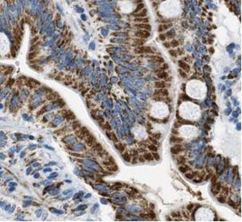 VIL1 Rabbit Polyclonal Antibody