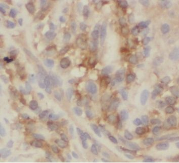 VIL1 Antibody