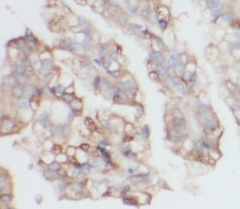 VIM Mouse Monoclonal Antibody