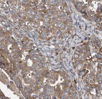 NAMPT Antibody