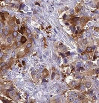 DCAF1 Antibody