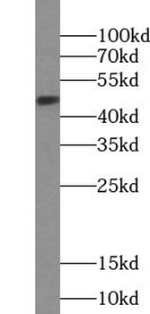 VPREB3 Antibody