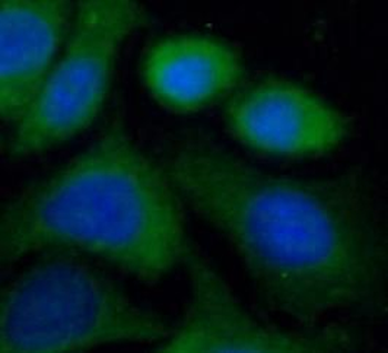 VPS18 Antibody