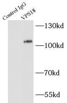 VPS18 Antibody