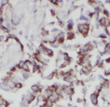 VPS18 Antibody