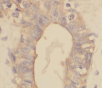 VPS25 Antibody