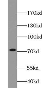 VPS33B Rabbit Polyclonal Antibody