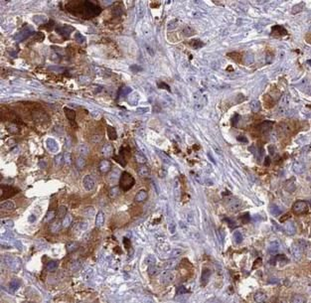 PIK3C3 Antibody