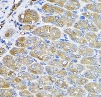 VPS37A Antibody