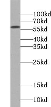 VPS72 Antibody