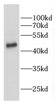 VRK2 Rabbit Polyclonal Antibody