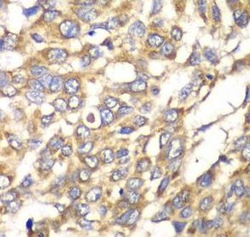 VTI1B Antibody
