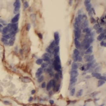 VWA2 Antibody
