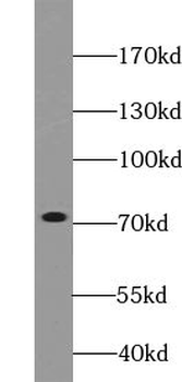 VWF VWFpp Rabbit Polyclonal Antibody