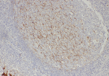 VWF VWFpp Rabbit Polyclonal Antibody