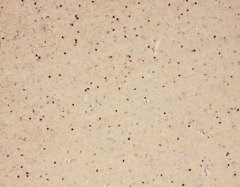 WASL antibody