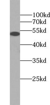 WAS Rabbit Polyclonal Antibody