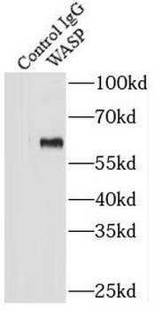 WAS Rabbit Polyclonal Antibody
